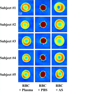 Effects of osmolality and solutes on the morphology of red blood cells according to three-dimensional refractive index tomography